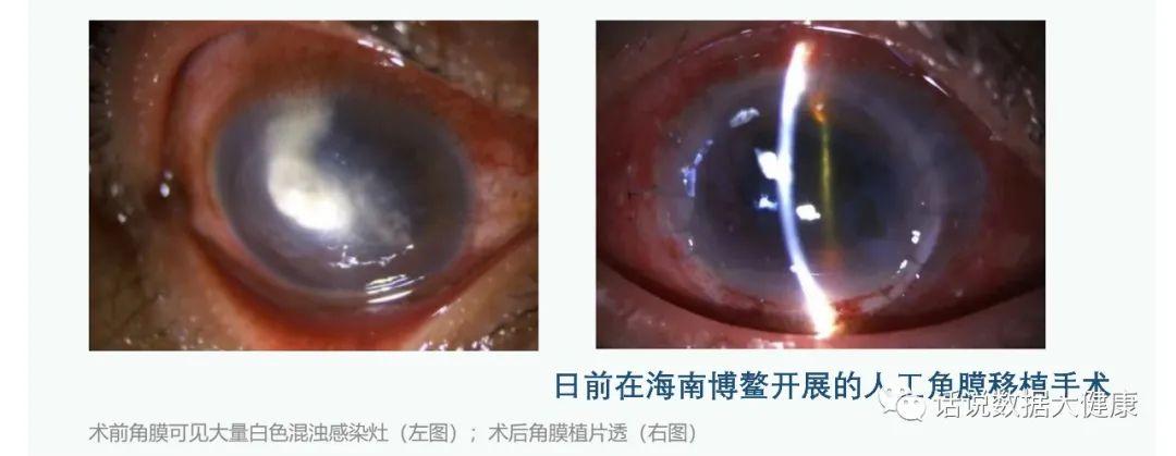 最新儿童视力研究及其重要性