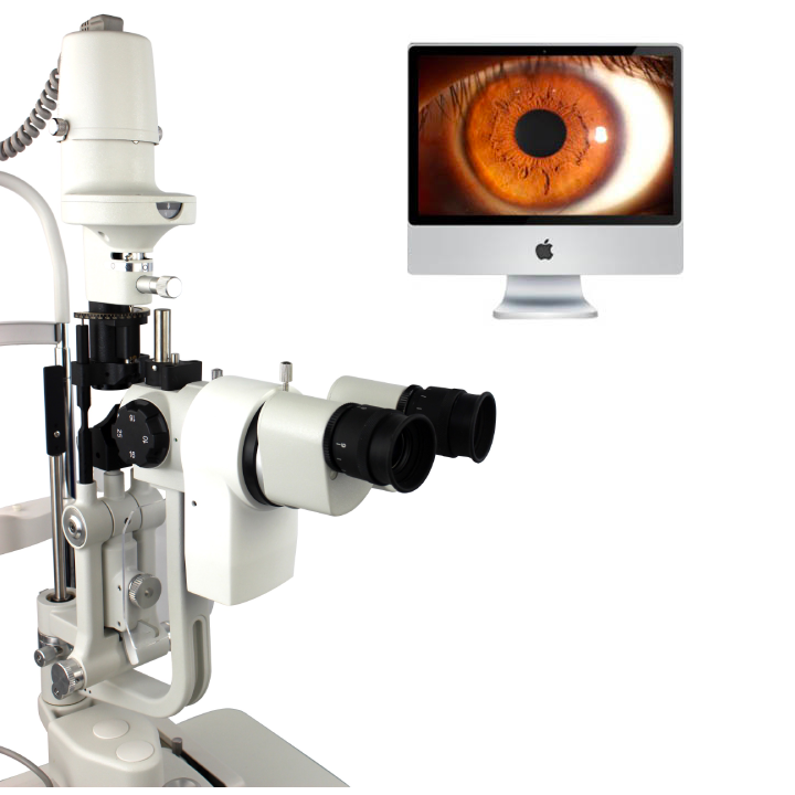 最新裂隙灯技术及其在医学领域的应用